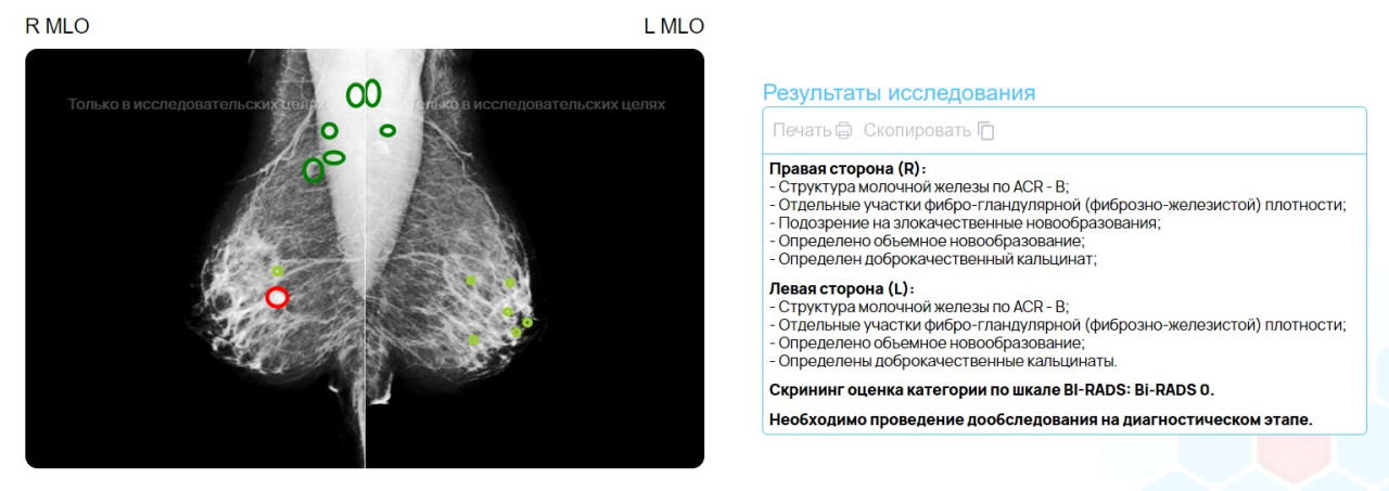 Кто такой ML-инженер и как им стать